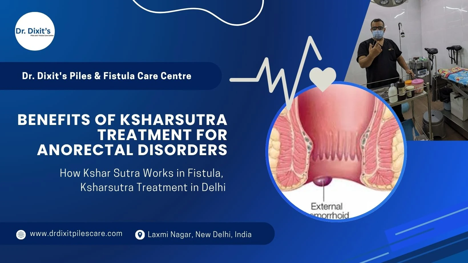 Top Benefits of Ksharsutra Treatment for Anorectal Disorders in India