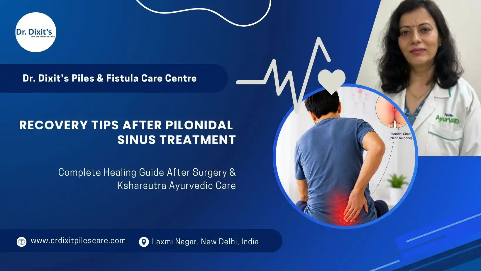 Recovery Tips After Pilonidal Sinus Treatment: Complete Healing Guide