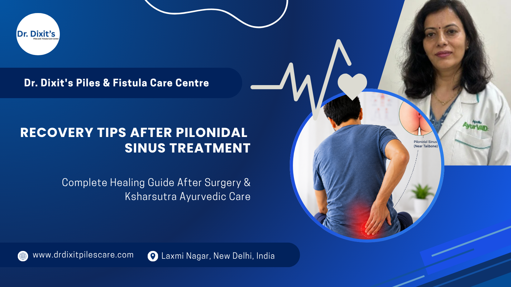 Recovery Tips After Pilonidal Sinus Treatment: Complete Healing Guide