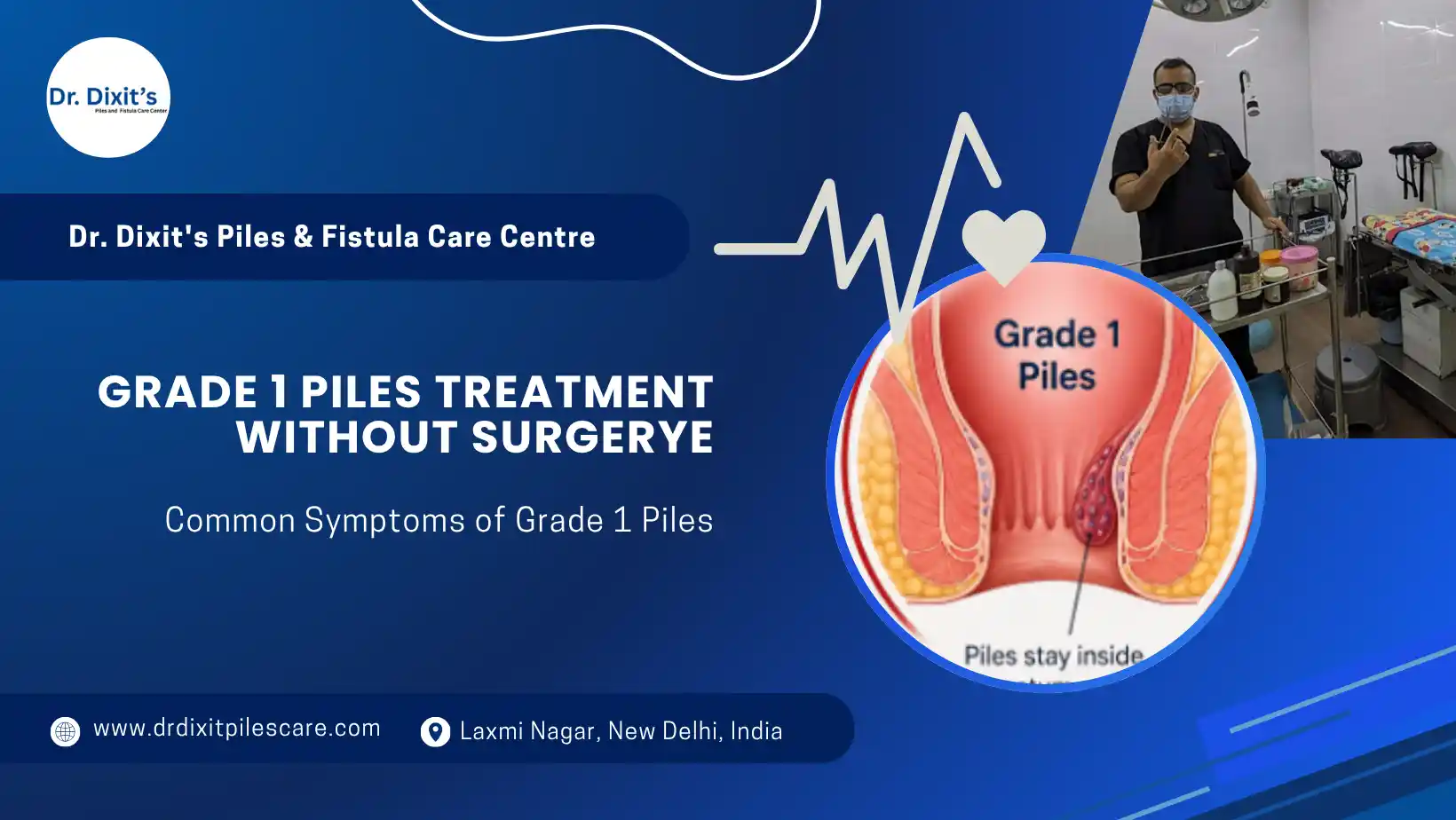 Grade 1 Piles Treatment Symptoms Causes and Early Care