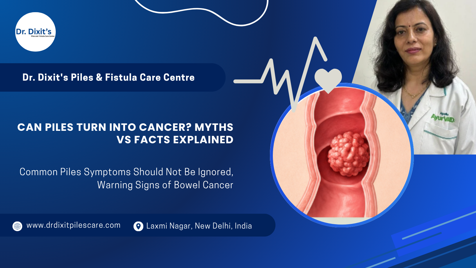 Can Piles Turn Into Cancer? Myths vs Facts Explained